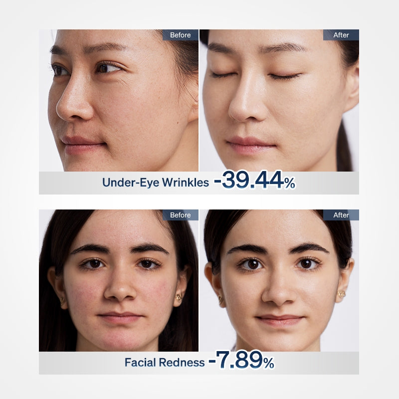 Ulike ReGlow LED Face Mask Glowing Results in 14 Days